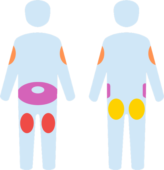 figuras que muestran zonas preferibles de inyeccion en el cuerpo por delante y por detrás